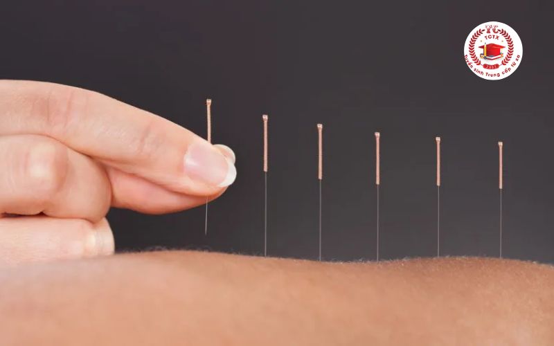 Những ai nên theo học ngành Trung cấp Y sĩ Y học cổ truyền?